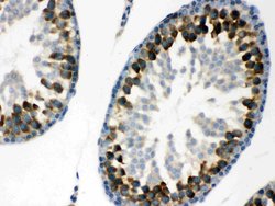 Invitrogen YBX1 Polyclonal Antibody 100 &mu;g; Unconjugated:Antibodies,