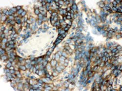 Invitrogen YBX1 Polyclonal Antibody 100 &mu;g; Unconjugated:Antibodies,