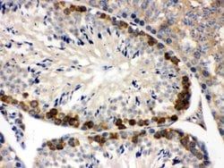 Invitrogen YBX1 Polyclonal Antibody 100 &mu;g; Unconjugated:Antibodies,