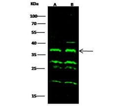 Invitrogen CTLA-4 Polyclonal Antibody 100 &mu;L | Buy Online | Invitrogen&trade; | Fisher Scientific