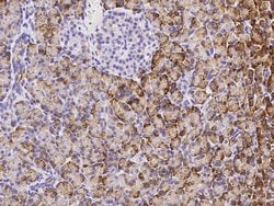 Invitrogen REG1A Polyclonal Antibody 100 &mu;L | Buy Online | Invitrogen&trade; | Fisher Scientific