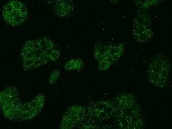 Invitrogen ABCD1 Polyclonal Antibody 100 &mu;L; Unconjugated:Antibodies,