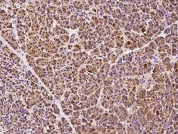 Invitrogen ABCD1 Polyclonal Antibody 100 &mu;L; Unconjugated:Antibodies,