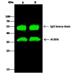Invitrogen ACBD6 Polyclonal Antibody 100 &mu;L; Unconjugated:Antibodies,