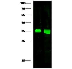 Invitrogen ACBD6 Polyclonal Antibody 100 &mu;L; Unconjugated:Antibodies,