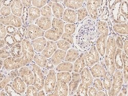 Invitrogen Acid Phosphatase 1 Polyclonal Antibody 100 &mu;L; Unconjugated:Antibodies,