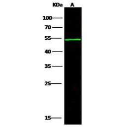 Invitrogen ACVR1B Polyclonal Antibody 100 &mu;L; Unconjugated:Antibodies,
