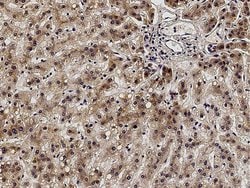 Invitrogen ACVRL1 Polyclonal Antibody 100 &mu;L; Unconjugated:Antibodies,