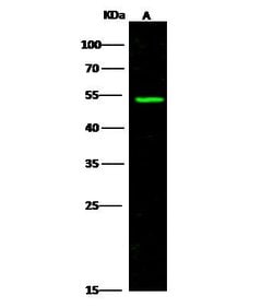 Invitrogen ACVRL1 Polyclonal Antibody 100 &mu;L; Unconjugated:Antibodies,