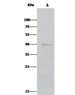 Invitrogen Aminoacylase Polyclonal Antibody 100 &mu;L; Unconjugated:Anticuerpos