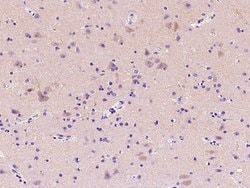 Invitrogen™ Adenosine Deaminase Polyclonal Antibody