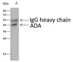 Invitrogen Adenosine Deaminase Polyclonal Antibody 100 &mu;L; Unconjugated:Antibodies,