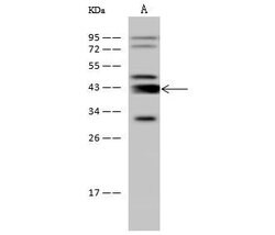 Invitrogen Adenosine Deaminase Polyclonal Antibody 100 &mu;L; Unconjugated:Antibodies,