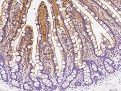 Adenosine Deaminase Rabbit anti-Human, Polyclonal, Invitrogen 100 &mu;L;