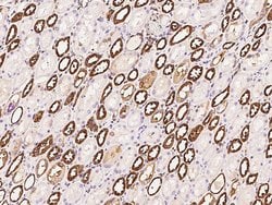 Invitrogen alpha Adducin Polyclonal Antibody 100 &mu;L; Unconjugated:Antibodies,