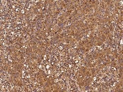 Invitrogen alpha Adducin Polyclonal Antibody 100 &mu;L; Unconjugated:Antibodies,