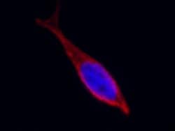 Invitrogen CD97 Polyclonal Antibody 100 &mu;L; Unconjugated:Antibodies,