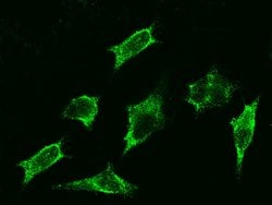 Invitrogen beta-2 Adrenergic Receptor Polyclonal Antibody 100 &mu;L; Unconjugated:Antibodies,