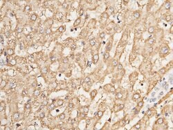 Invitrogen Adenylate Kinase 2 Polyclonal Antibody 100 &mu;L; Unconjugated:Antibodies,
