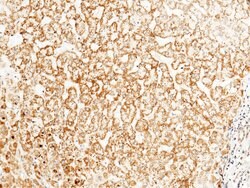 Intestinal Alkaline Phosphatase Polyclonal Antibody, Invitrogen 100 &mu;L;