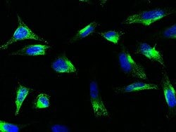 Invitrogen DOG-1 Polyclonal Antibody 100 &mu;L; Unconjugated:Antibodies,