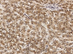 Invitrogen ApoA1 Polyclonal Antibody 100 &mu;L; Unconjugated:Antibodies,