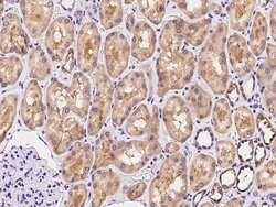 Invitrogen ARHGAP11A Polyclonal Antibody 100 &mu;L; Unconjugated:Antibodies,