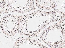 Invitrogen ARHGAP28 Polyclonal Antibody 100 &mu;L | Buy Online | Invitrogen&trade; | Fisher Scientific
