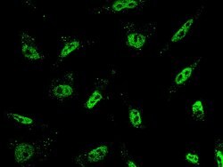 ARID1B Polyclonal Antibody, Invitrogen 100 &mu;L | Buy Online | Thermo Scientific | Fisher Scientific