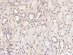 ARID1B Polyclonal Antibody, Invitrogen 100 &mu;L | Buy Online | Thermo Scientific | Fisher Scientific