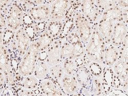 ARID1B Polyclonal Antibody, Invitrogen 100 &mu;L | Buy Online | Thermo Scientific | Fisher Scientific