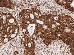 Invitrogen DRIL1 Polyclonal Antibody 100 &mu;L; Unconjugated:Antibodies,