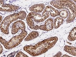 Invitrogen ASF1B Polyclonal Antibody 100 &mu;L; Unconjugated:Antibodies,