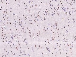 Invitrogen ATF Polyclonal Antibody 100 &mu;L | Buy Online | Invitrogen&trade; | Fisher Scientific