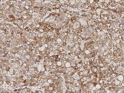 Invitrogen ATP5D Polyclonal Antibody 100 &mu;L; Unconjugated:Antibodies,