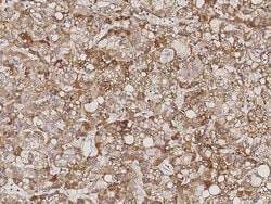 Invitrogen ATP5D Polyclonal Antibody 100 &mu;L; Unconjugated:Antibodies,