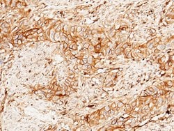 beta-2 Microglobulin/FCRN Polyclonal Antibody:Antibodies, Polyclonal