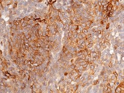 beta-2 Microglobulin/FCRN Polyclonal Antibody:Antibodies, Polyclonal