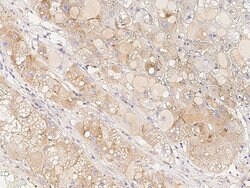 Invitrogen BAD Polyclonal Antibody 100 &mu;L; Unconjugated:Antibodies,
