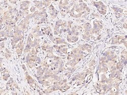 Invitrogen BAD Polyclonal Antibody 100 &mu;L; Unconjugated:Antibodies,