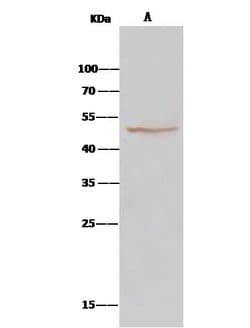 Invitrogen BLMH Polyclonal Antibody 100 &mu;L; Unconjugated:Antibodies,