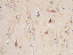 Invitrogen BLNK Polyclonal Antibody 100 &mu;L; Unconjugated:Antibodies,