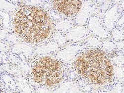 Invitrogen BST-2 Polyclonal Antibody 100 &mu;L; Unconjugated:Antibodies,