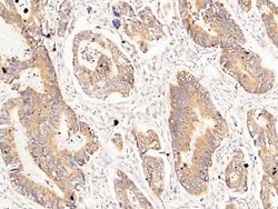 Invitrogen Carbonic Anhydrase XII Polyclonal Antibody 100 &mu;L; Unconjugated:Antibodies,