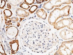 Invitrogen Carbonic Anhydrase XII Polyclonal Antibody 100 &mu;L; Unconjugated:Antibodies,