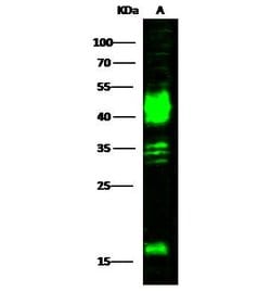 Invitrogen Carbonic Anhydrase XII Polyclonal Antibody 100 &mu;L; Unconjugated:Antibodies,