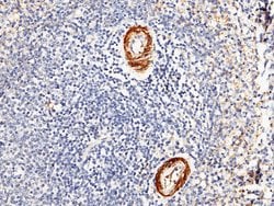 Invitrogen Carbonic Anhydrase III Polyclonal Antibody 100 &mu;L; Unconjugated:Antibodies,
