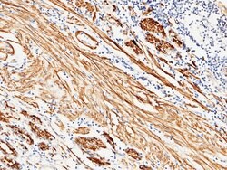 Invitrogen Carbonic Anhydrase III Polyclonal Antibody 100 &mu;L; Unconjugated:Antibodies,
