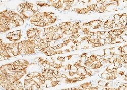 Invitrogen™ Carbonic Anhydrase IX Polyclonal Antibody