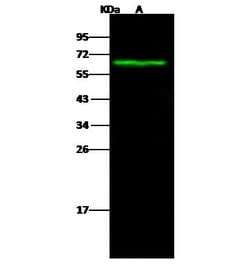 Invitrogen Carbonic Anhydrase IX Polyclonal Antibody 100 &mu;L; Unconjugated:Antibodies,